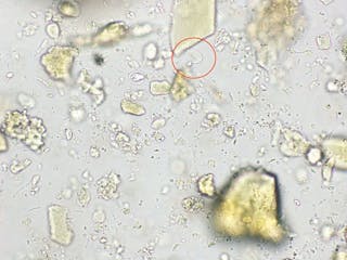 Mischinfektion mit Giardien-Zysten (rote Pfeile) und einigen Cystoisospora-Zysten in einer Kotprobe (x200)